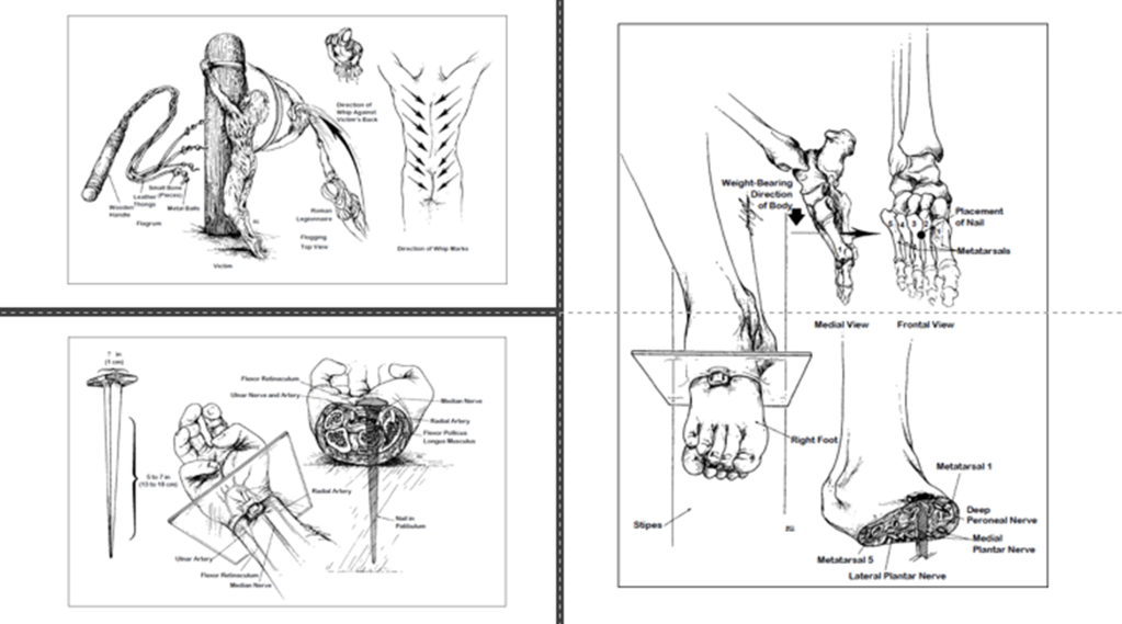 La Muerte Física de Jesucristo: Un Análisis&nbsp;Médico
